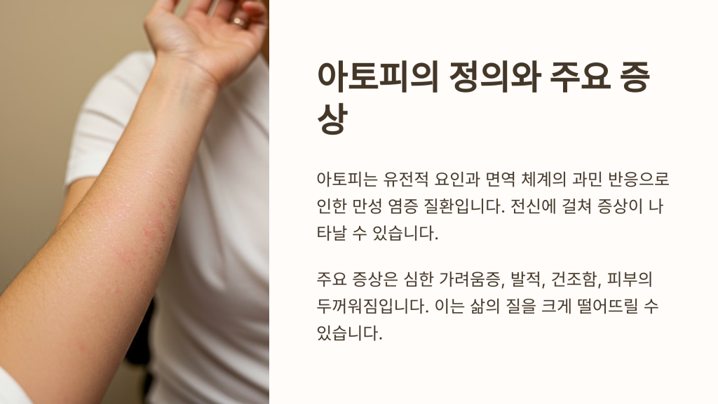 아토피