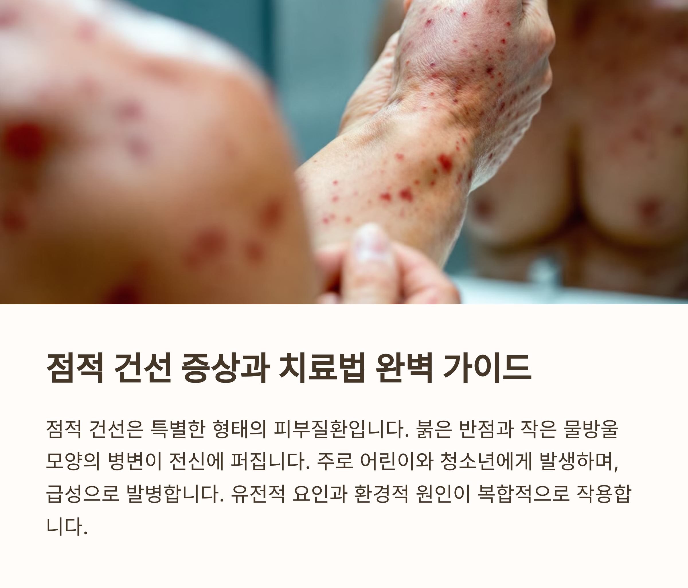 점적 건선