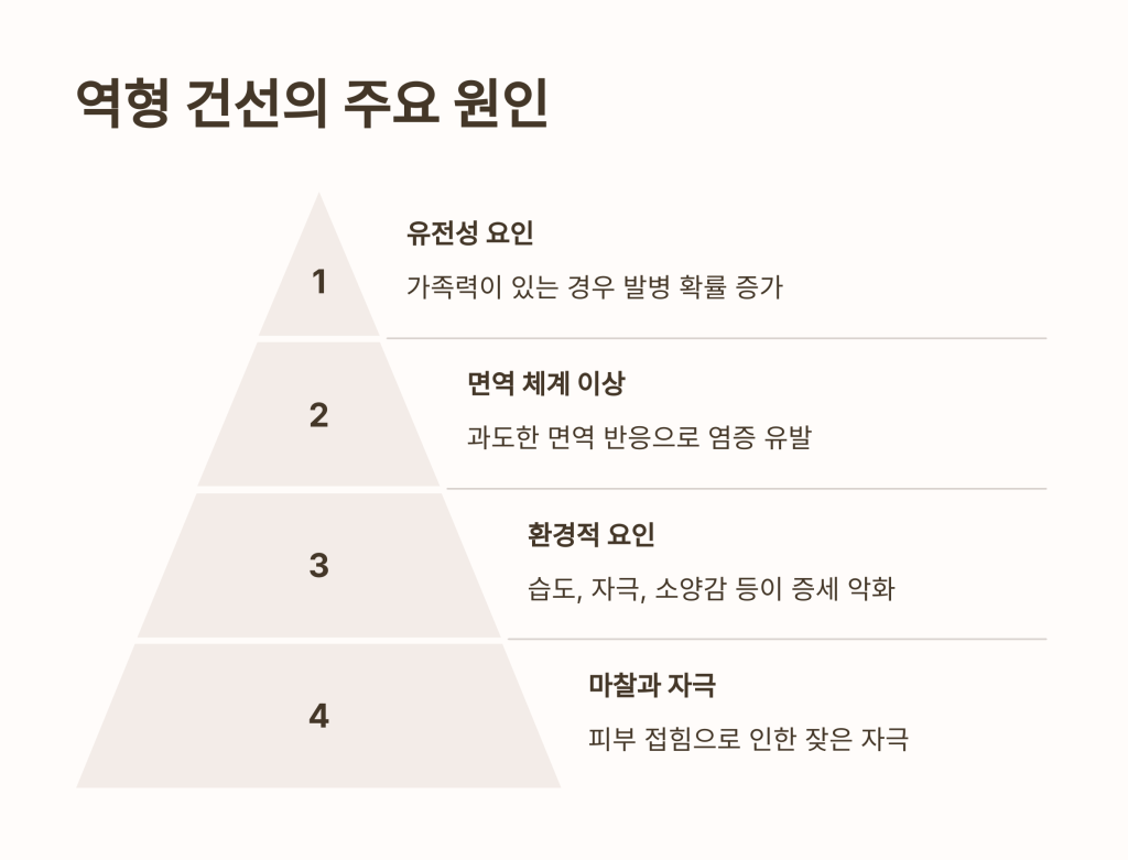 역형 건선