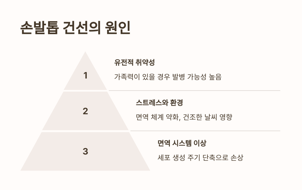 손발톱 건선