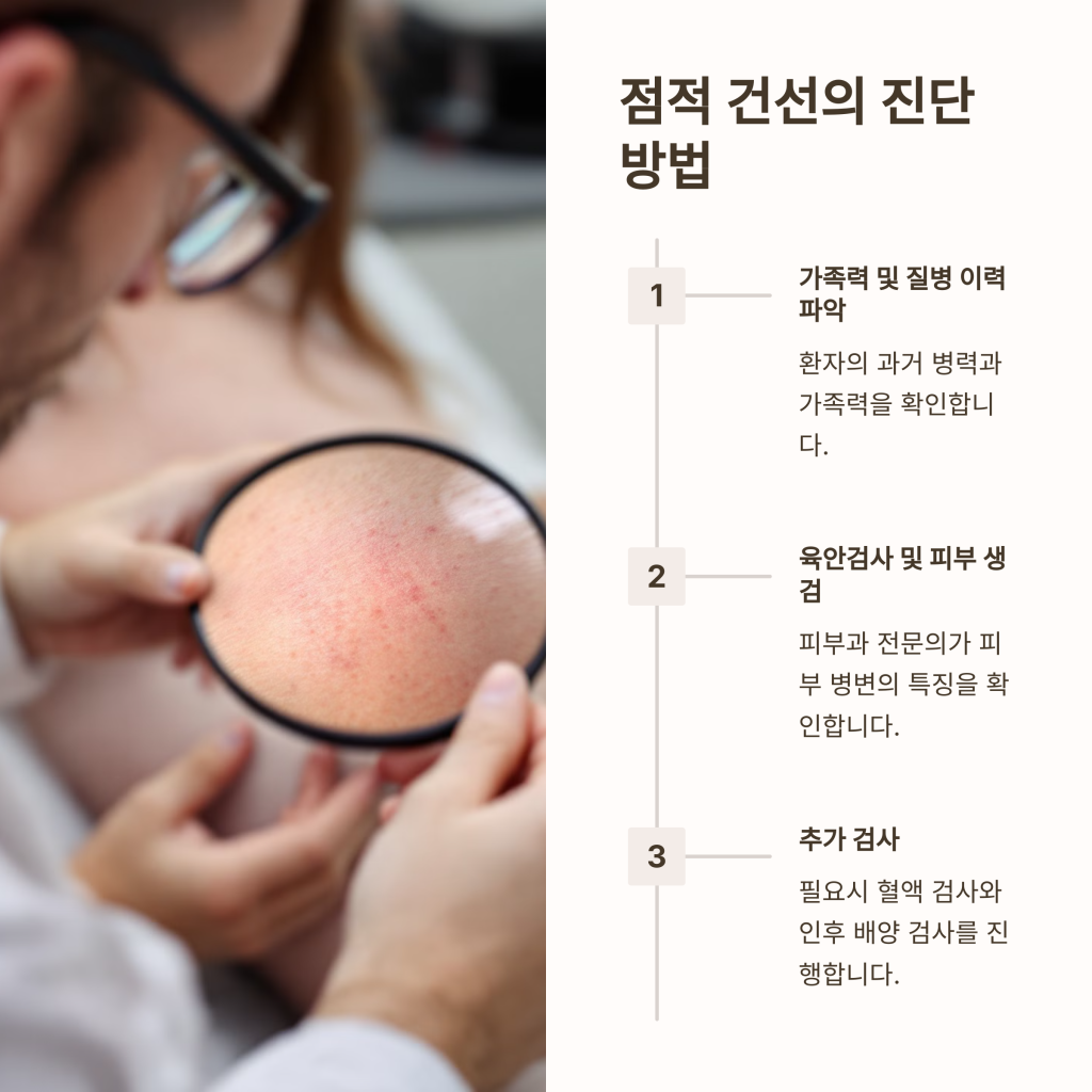 점적 건선